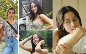 10 Pesona Natural Laura Theux Usai Hempas Nyinyiran Punya Bekas Jerawat