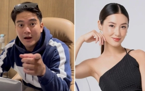 Boy William Dipuji Eks Tunangan usai Oplas Hidung di Korea