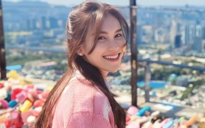 Ayu Ting Ting Hebohkan Fans Gara-Gara Warna Kulit Belang