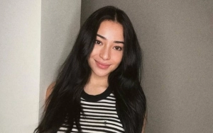 Nikita Willy Dikira Oplas Hidung usai Pamer Look Wajah Beda di Foto Keluarga