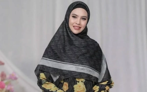 Kartika Putri Dirawat di Singapura usai Wajah dan Lidah Mendadak Melepuh