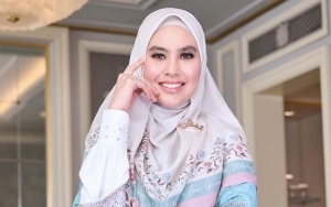 Kartika Putri Klarifikasi Rumor Miring Soal Penyakit Wajahnya