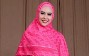  Kartika Putri Perlihatkan Kondisi Wajah Terkini Usai Penyakitnya Disebut Adzab