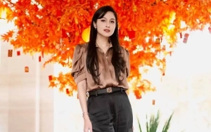Sandra Dewi Mendadak Jalani Operasi di Rumah Sakit