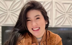 Dokter Analisa Benda Aneh di Foto Rontgen Stevie Agnecya di Tengah Isu Santet Level Tinggi