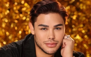 Ivan Gunawan Bikin Khawatir Sederet Rekan Artis usai Pajang Potret Wajah Memar