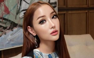 Lucinta Luna Ungkap Kondisi setelah Lakukan Operasi Pita Suara 