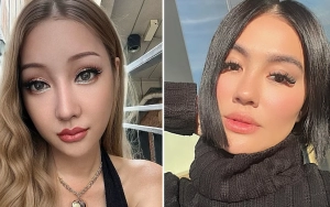 Lucinta Luna Siap Saingi Agnez Mo usai Spill Penampakan Leher pasca Operasi Pita Suara