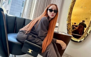 Wajah Baru Lucinta Luna pasca Kembali Oplas Nyaris Tak Dikenali