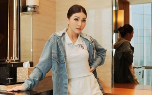 Wajah Sarwendah usai Operasi Plastik di Korea Bikin Pangling hingga Dikira Mirip Inul Daratista