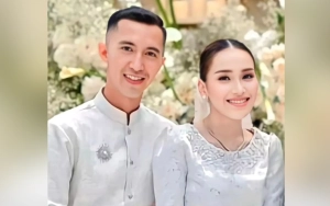 Viral Foto Ayu Ting Ting Pamer Wajah Sembab bak Kuatkan Kabar Putus di Awal Juni