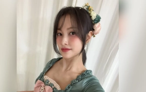 Park Gyuri Jalani Operasi Wajah Tepat Sebelum KARA Comeback