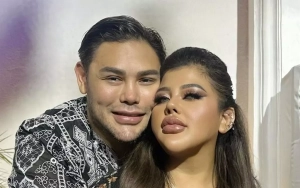 Ivan Gunawan Apresiasi Perjuangan Shindy Samuel yang Kini Bertubuh Ramping