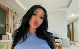 Jessi Bongkar Awalnya Dipaksa Operasi Plastik dan Jadi Ketagihan