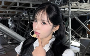 Pengakuan Jiwon fromis9 Pernah Cangkok Rambut Jadi Perbincangan Panas