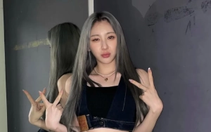 Lee Chaeyeon Bikin Ngilu Pamer Hasil Rontgen Tulang Punggung yang Cedera