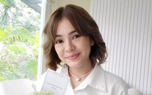 Wajah Maya Septha Jadi Perbincangan Pasca Lakukan Oplas