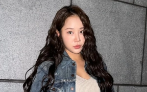 Soyou eks SISTAR Akui Pernah Pingsan di Jalan dan Ditolong Orang Asing ke UGD