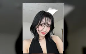 Momo TWICE Terpaksa Jalani Prosedur Gigi Mendadak, Menyulut Kekhawatiran Fans