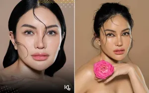 Nikita Mirzani Kembali ke Rutan Usai Operasi Tulang Belakang