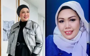 Elly Sugigi Disindir Anaknya Soal Operasi Plastik yang Dilakukannya