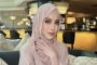 Anak Selebgram Emy Aghnia Disiksa Babysitter Hingga Lebam-Lebam