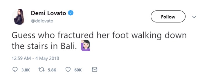 Demi Lovato alami cedera saat di Bali