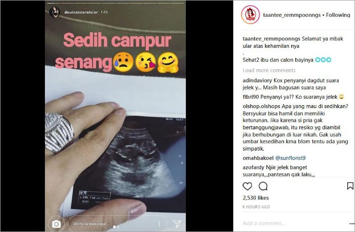 Dewi Sanca Unggah USG Calon Anak