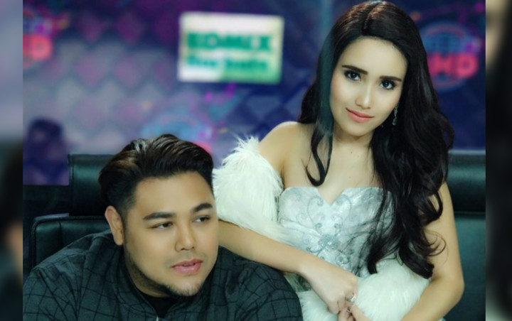 Mendadak Pingsan di 'Brownis', Ivan Gunawan Bikin Ayu Ting Ting Syok