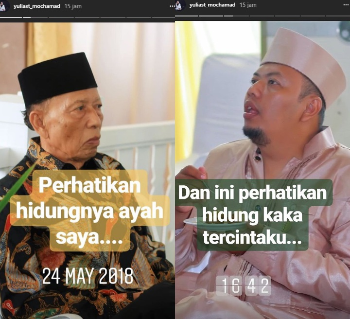 Yulia Muhammad Buka Suara Soal Tudingan Hidung Mancung Berkat Oplas