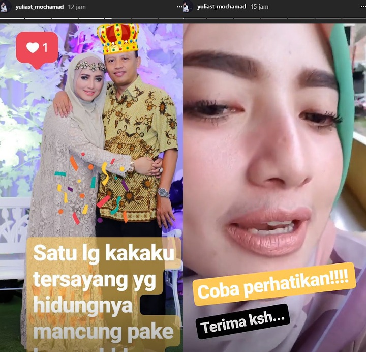 Yulia Muhammad Buka Suara Soal Tudingan Hidung Mancung Berkat Oplas