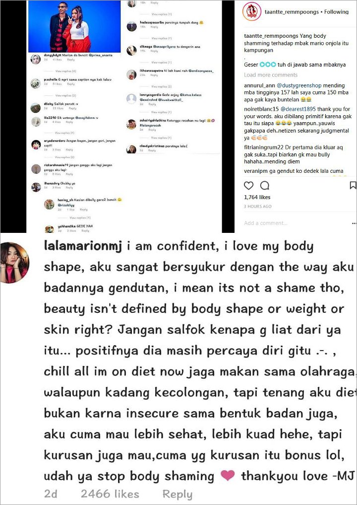 Perut Buncit Jadi Sorotan, Marion Jola Beri Jawaban Cerdas