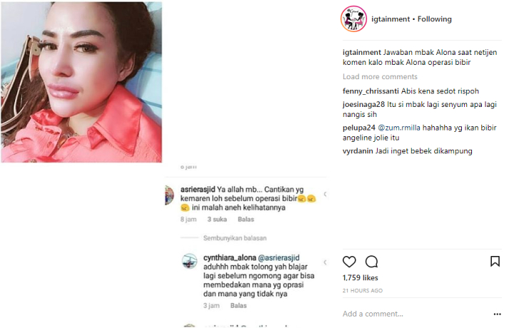Cynthiara Alona Diduga Lakukan Operasi Bibir