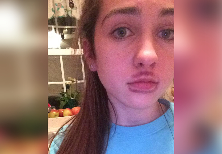 3. Kylie Jenner Lip Challenge yang Gagal Total