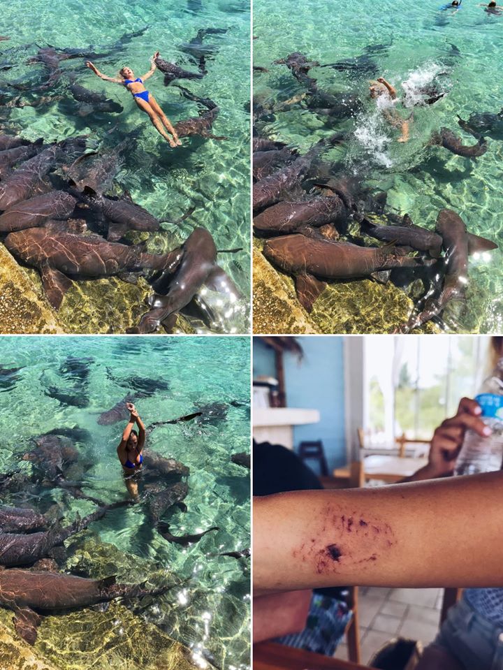 Asyik Berpose, Tangan Seorang Model Instagram di California Robek Akibat Diserang dan Digigit Hiu