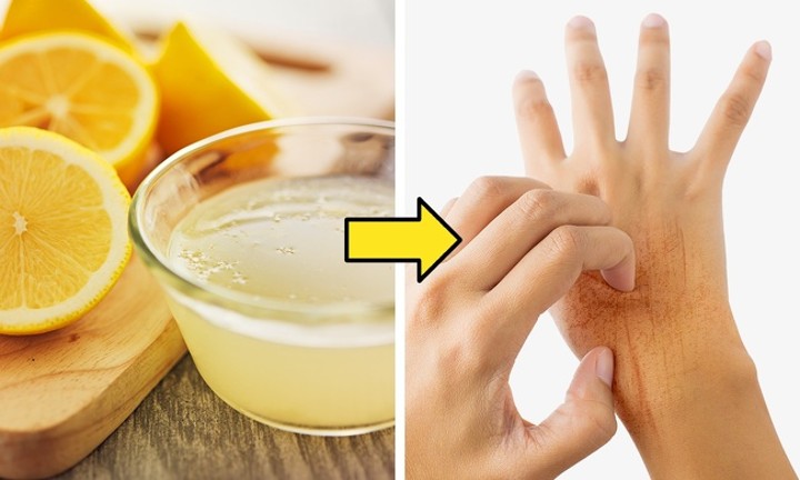 Jus Lemon dan Minyak Kelapa untuk Pertumbuhan Kuku