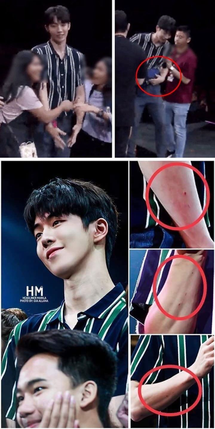 Lengan Nam Joo Hyuk Luka-Luka