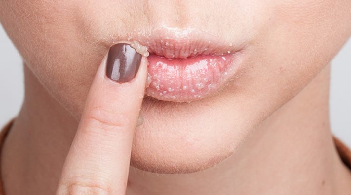 Gula Pasir untuk Menghaluskan Bibir Sekaligus Memerahkannya