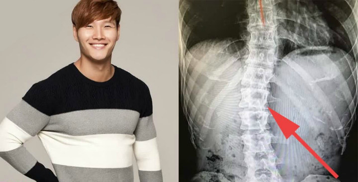 Serangkaian Cidera Kim Jong Kook