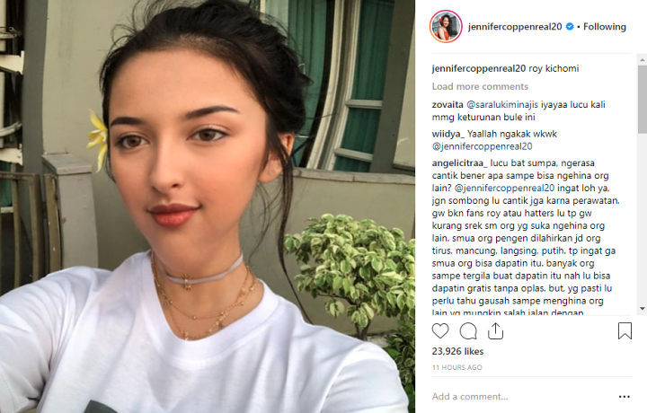 Ikut Tren Edit Wajah Dagu Lancip, Jennifer Coppen Malah Banjir Hujatan