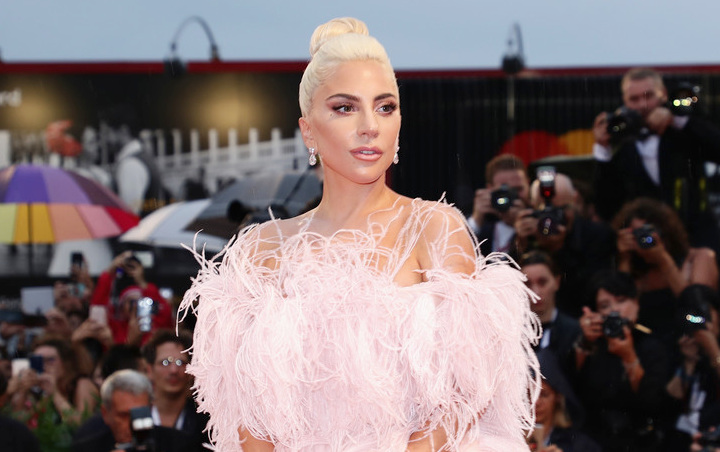 Terlihat Awet Muda, Lady Gaga Dituding Lakukan Oplas