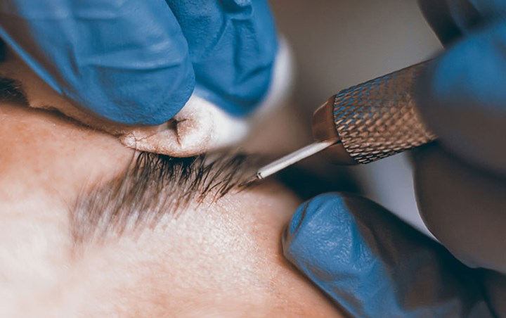 Eyebrow Microblading, Tren Sulam Alis Cantik yang Bisa Mematikan