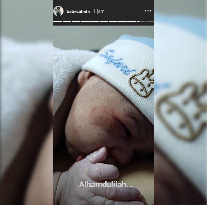 Resmi Jadi Ayah, Babe Cabita Kena Cakaran Sang Istri di Proses Persalinan