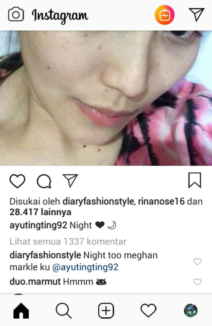 Ayu Ting Ting