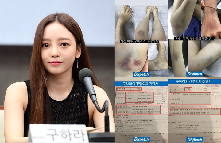 Goo Hara Alami Lebam dan Pendarahan Rahim