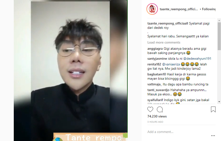 Usai Diisukan Operasi Plastik, Roy Kiyoshi Tampil Baru dengan Gigi Kelinci