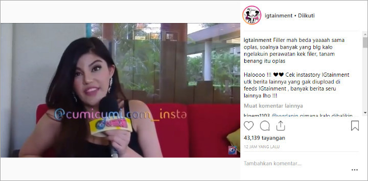 Calon Istri Denny Sumargo Akui Lakukan Filler Ketimbang Oplas, Begini Reaksi Warganet