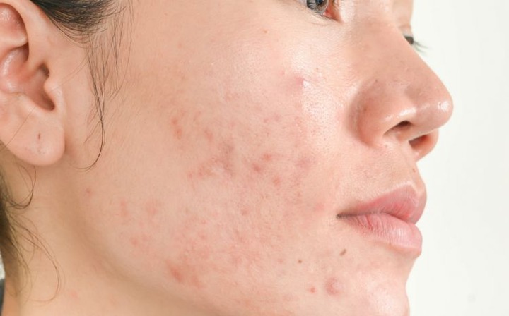 Ccrsp9ksgsnv2m Ccrsp9ksgsnv2m