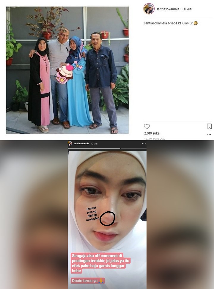 Istri Mark Sungkar Tutupi Perut Pakai Stiker