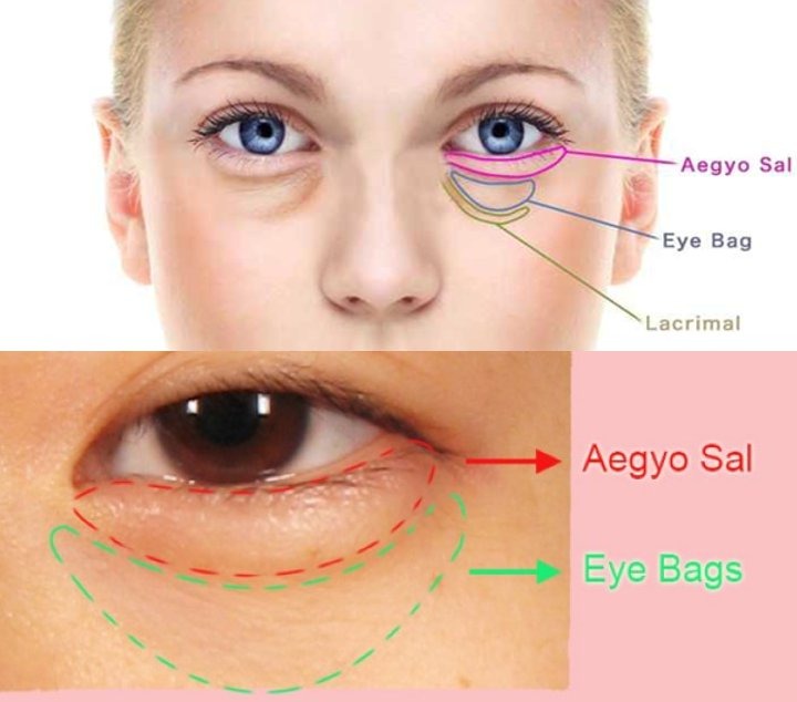 Menambah Kantung Mata Aegye-sal Agar Terlihat Imut